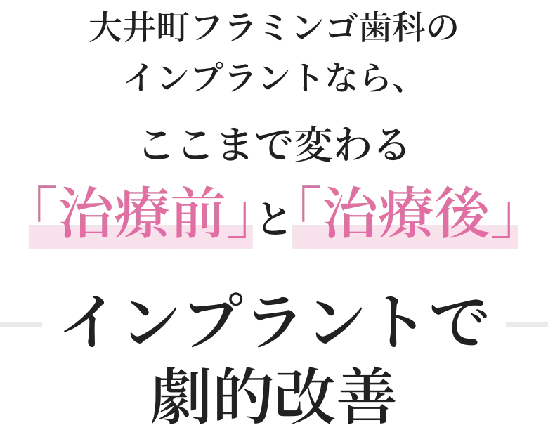 大井町フラミンゴ歯科のインプラントなら、ここまで変わる｢治療前｣と｢治療後｣インプラントで劇的改善