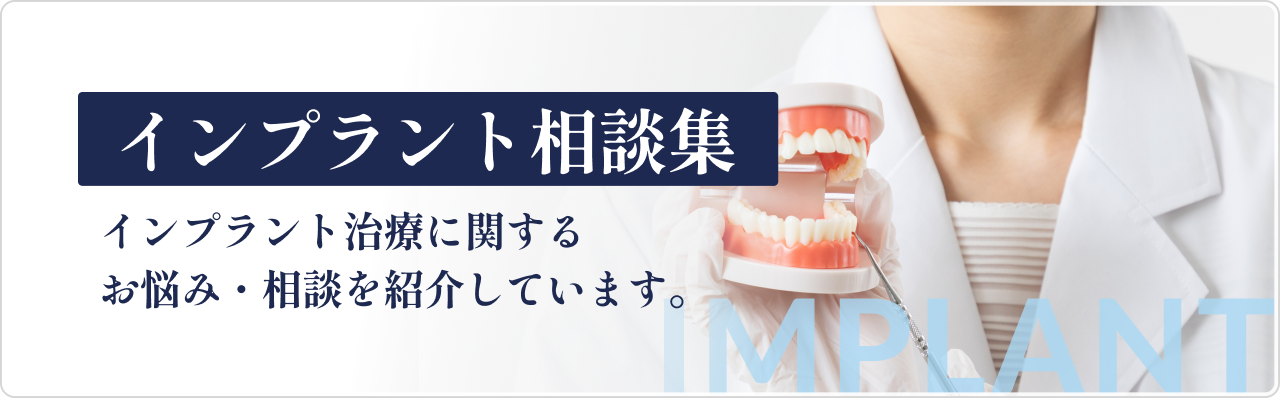 インプラント相談集 インプラント治療に関するお悩み・相談を紹介します