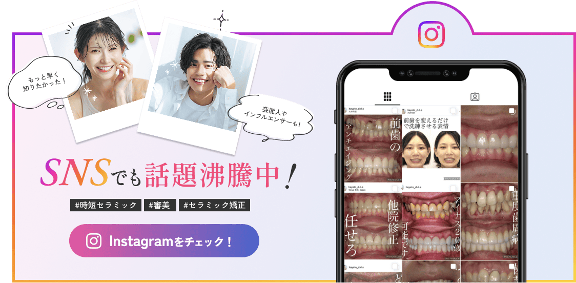 SNSでも話題沸騰 #時短セラミック #審美  #セラミック矯正 Instagramをチェック