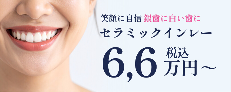 笑顔に銀歯に白い歯に セラミックインレー