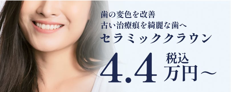 歯の変色を改善 古い治療痕を綺麗な歯へ セラミッククラウン：4.4万円（税込）