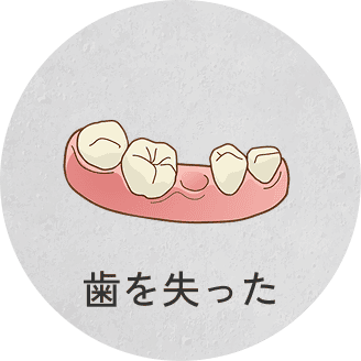 歯を失った