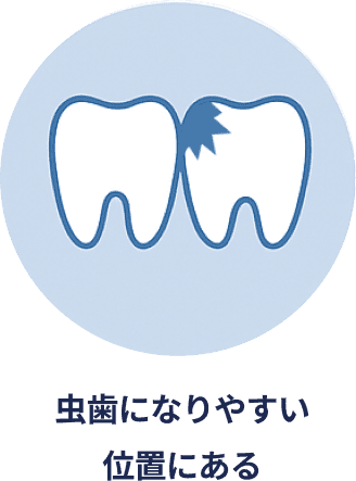 虫歯になりやすい位置にある