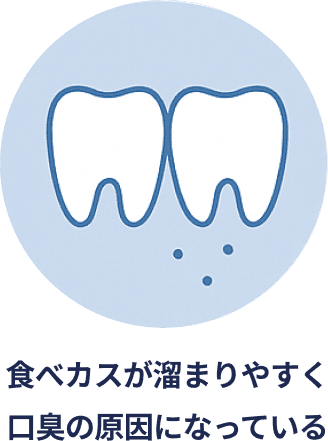 食べカスが溜まりやすく口臭の原因になっている