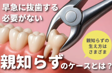 早急に抜歯する必要がない親知らず