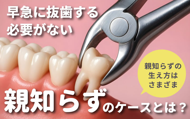 早急に抜歯する必要がない親知らず