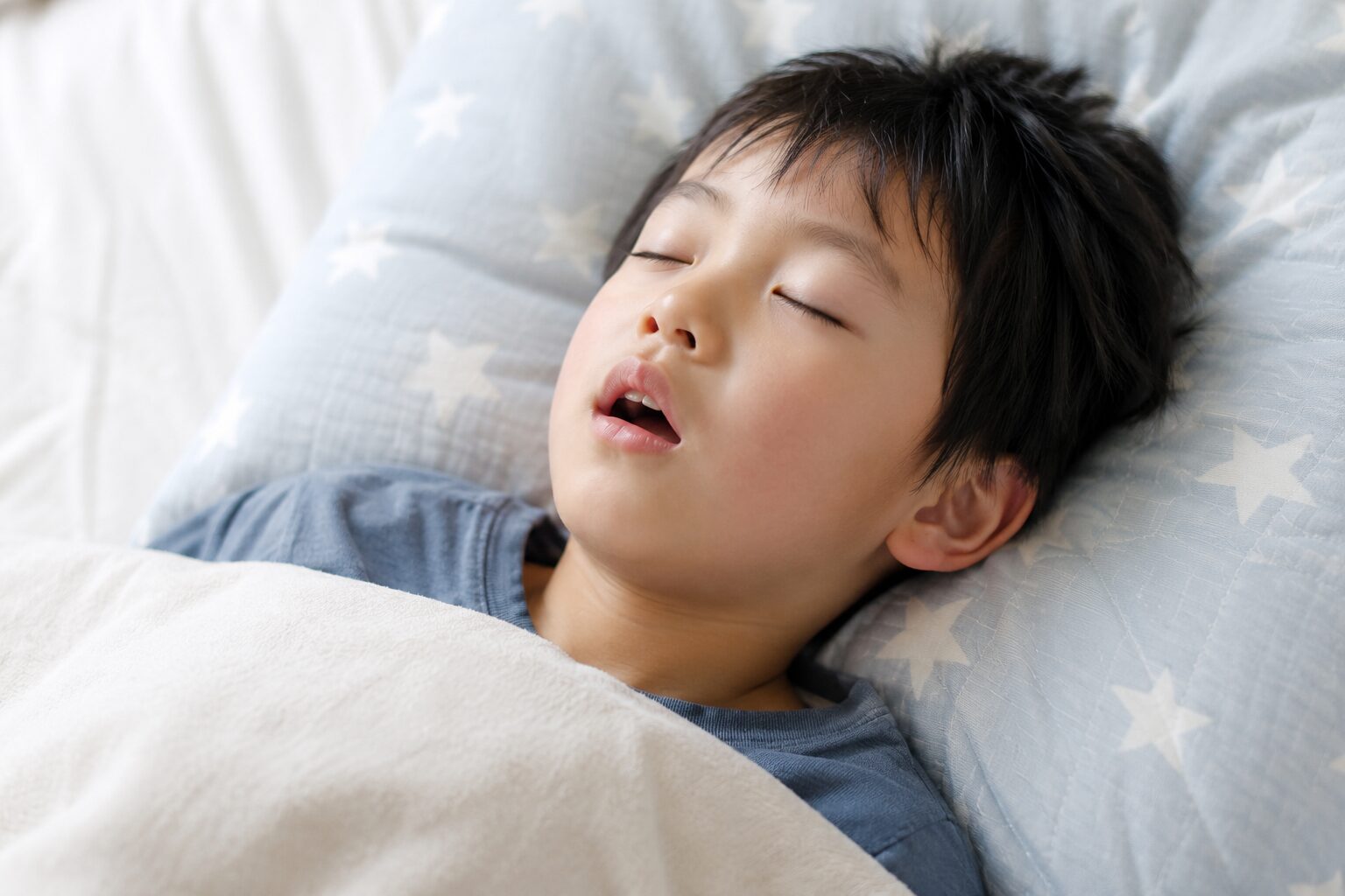 子ども 口呼吸