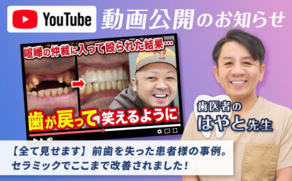 前歯を失った患者様の事例。セラミックでここまで改善されました！