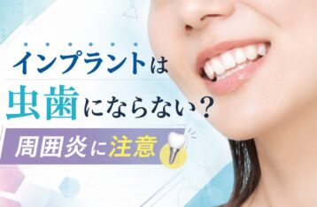 インプラントは虫歯にならない？周囲炎に注意