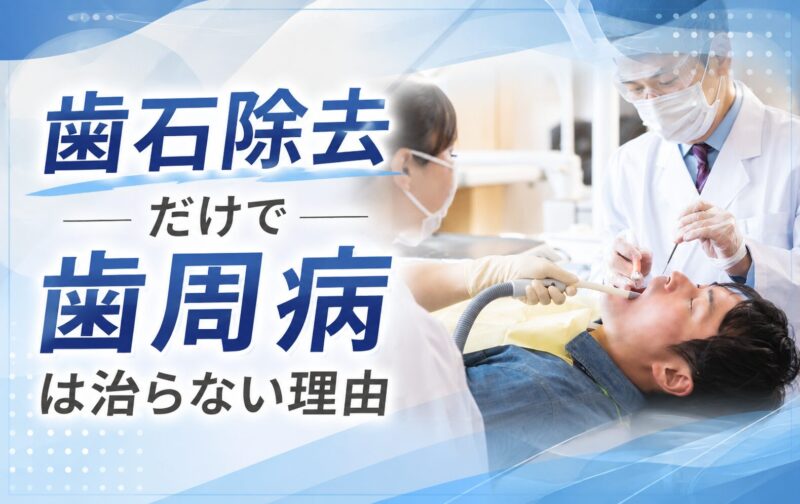 歯石除去だけで歯周病は治らない理由